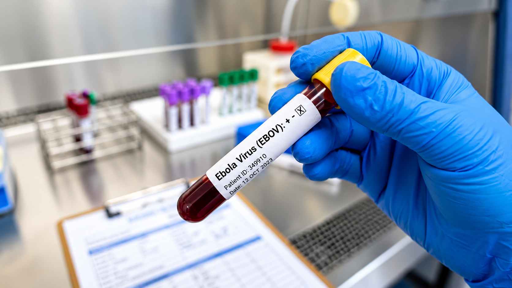 A healthcare worker handles a blood specimen prepared for Ebola testing.
